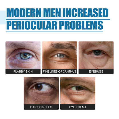 EELHOE Men S Eye Essence Reduces Fine Lines Under The Eyes Moisturizes And Tightens Brightens The Dark Circles Around The Eyes