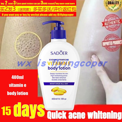 Lavender White Body Lotion Black Skin Armpit Inner Body Lotion