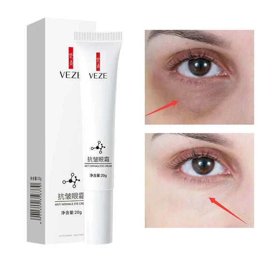 Nicotinamide Eye cream for Dark Circles, Bags, and Puffiness under the Eyes with Hyaluronic Acid and Moisturizing Serum