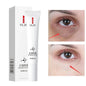 Nicotinamide Eye cream for Dark Circles, Bags, and Puffiness under the Eyes with Hyaluronic Acid and Moisturizing Serum