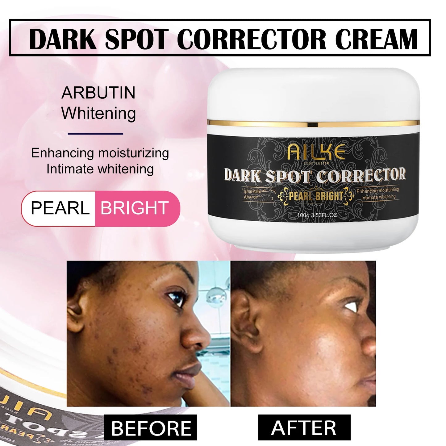 AILKE Collagen Whitening Kit, Skin Moisturizer, Hydration, Remove Dark Spots, Sun Spots, Freckles, Melanin, Even Skin Tone