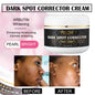 AILKE Collagen Whitening Kit, Skin Moisturizer, Hydration, Remove Dark Spots, Sun Spots, Freckles, Melanin, Even Skin Tone