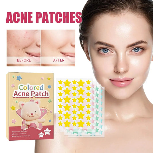 144pcs Colorful Star Acne Patches: Fade Pimple Marks, Clean Pores, Smooth Skin, Portable Pentagram Design