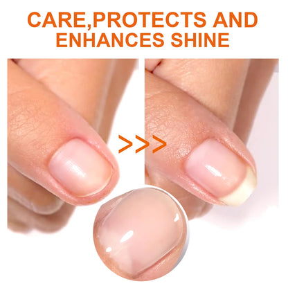 Nail-Aid Keratin 3 Day Growth,Stop Your Nails From Chipping And Peeling,Nail Care Products, Harden Your Nails,Enhance Nail Gloss