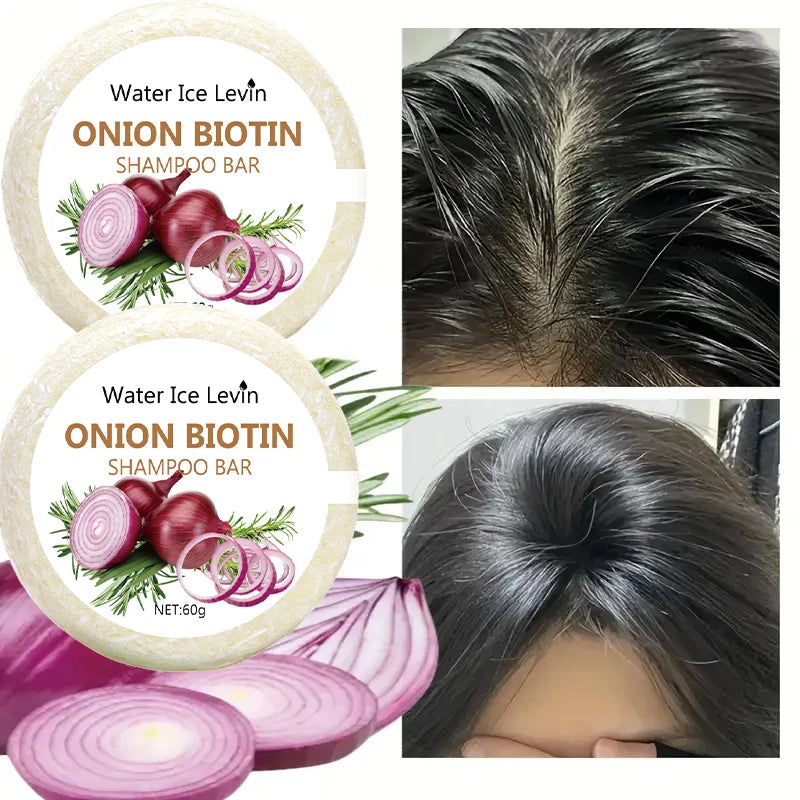 Onion & Biotin Shampoo Bar – 60g Moisturizing, Smoothing Hair Soap with Rosemary Extract