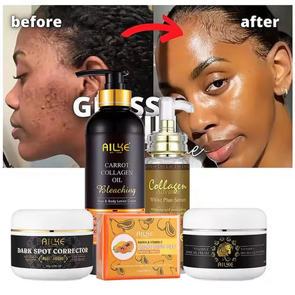 AILKE Collagen Whitening Kit, Skin Moisturizer, Hydration, Remove Dark Spots, Sun Spots, Freckles, Melanin, Even Skin Tone