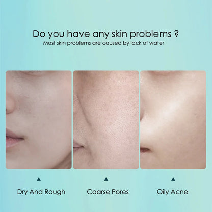 10‑Pack Hyaluronic Acid Hydrating Sheet Masks – Moisturizing, Pore‑Refining Facial Skincare