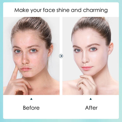 10‑Pack Hyaluronic Acid Hydrating Sheet Masks – Moisturizing, Pore‑Refining Facial Skincare