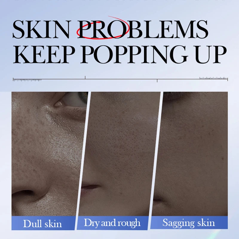 5PCS SADOER Hyaluronic Acid Caviar Facial Masks – Brightening, Firming & Deep Hydration Skincare