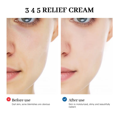 345 Relief Cream Comprehensive solution to skin problems Anti-sugar and antioxidant Brightening skin Improving acne marks