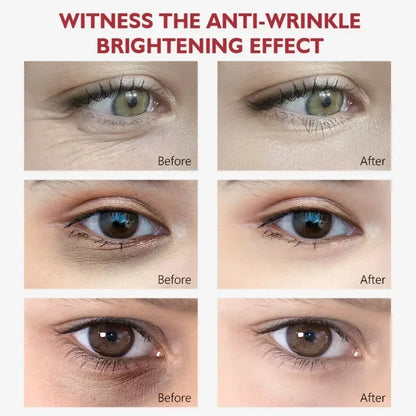 Nicotinamide Eye cream for Dark Circles, Bags, and Puffiness under the Eyes with Hyaluronic Acid and Moisturizing Serum